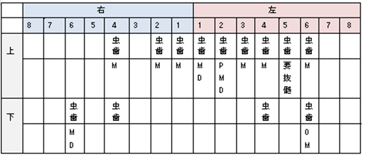 虫歯の表２