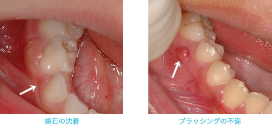 こんな症状に注意してください