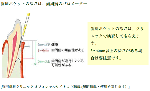 歯周病の進行